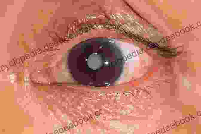 A Cataract In The Eye See Better: Healing Common Eye Diseases