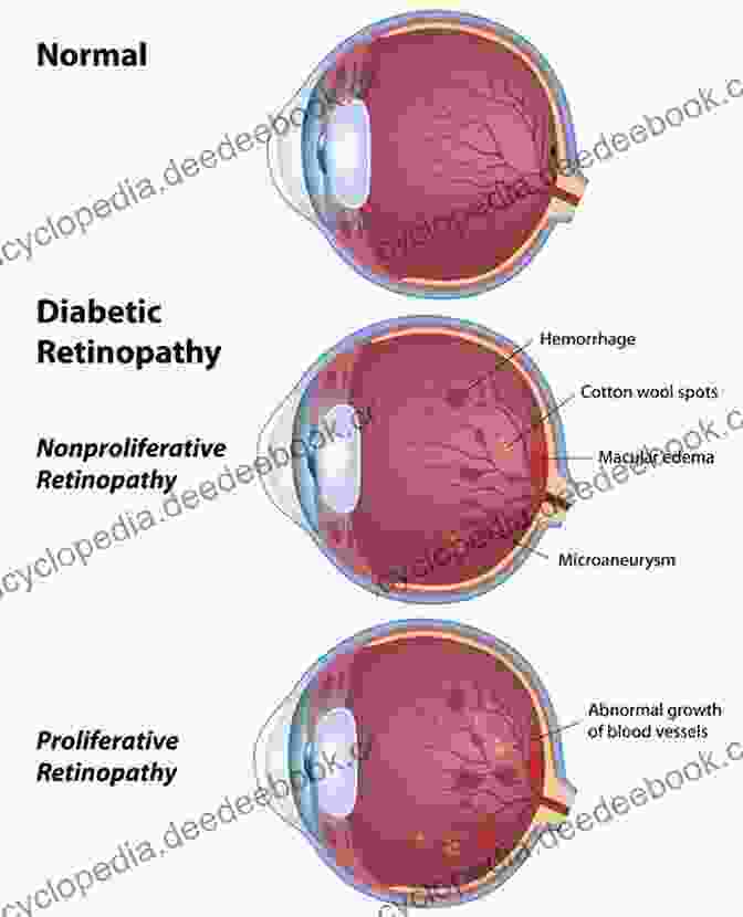 A Person With Diabetic Retinopathy See Better: Healing Common Eye Diseases