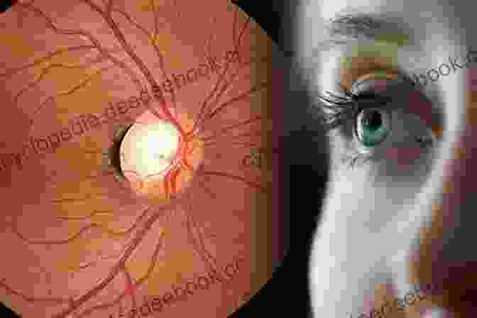 A Person With Glaucoma See Better: Healing Common Eye Diseases