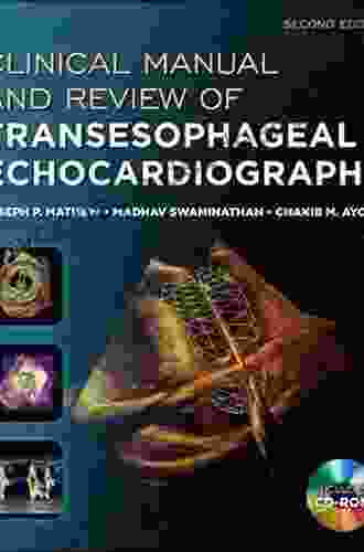 Clinical Manual And Review Of Transesophageal Echocardiography Second Edition